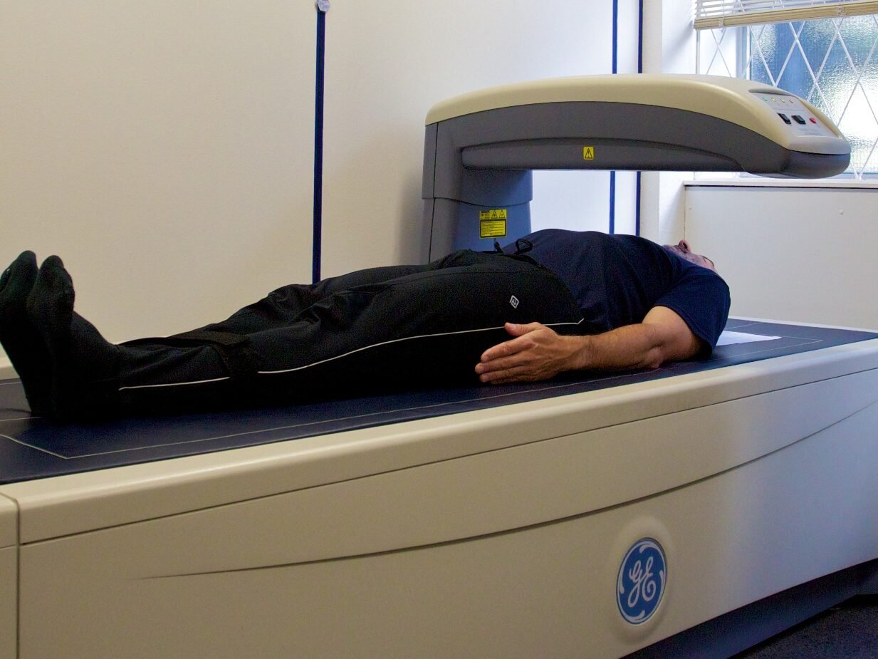Connection Between BMI, DEXA Test & Bone Density 3 dexa