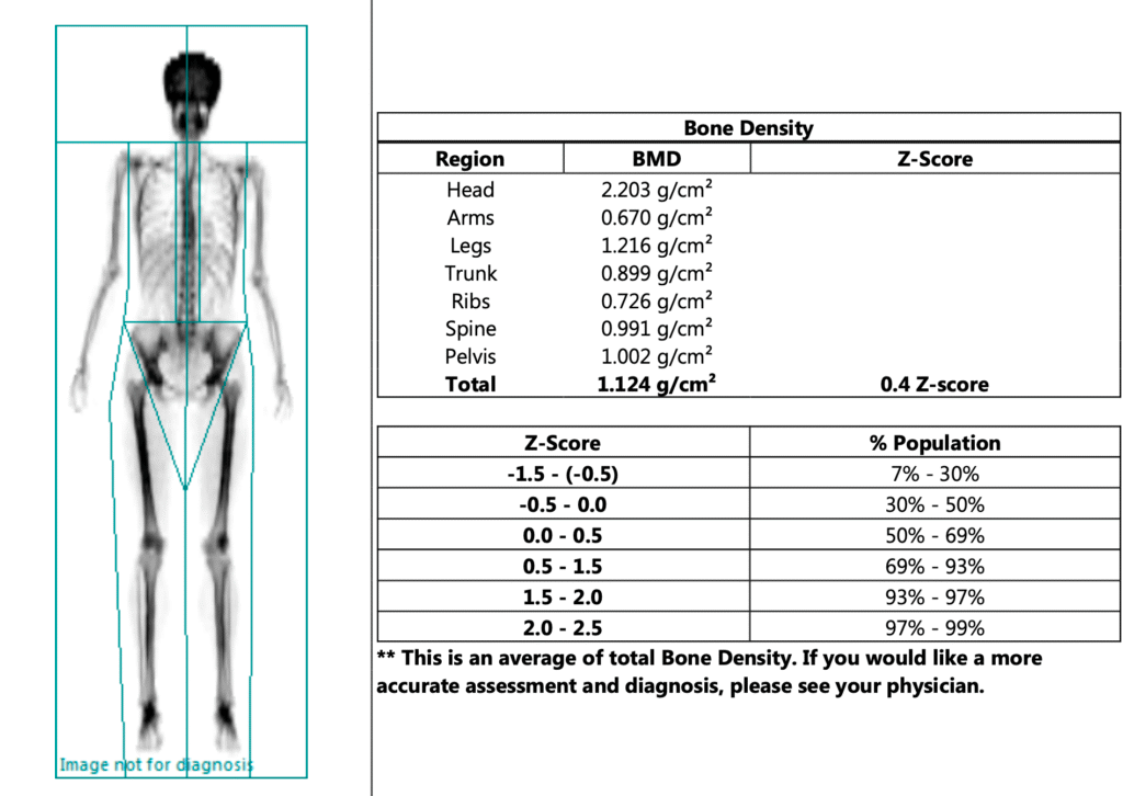 Connection Between BMI, DEXA Test & Bone Density 4 dexa res