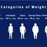 Morbid Obesity BMI 2025: Master Health & Beat the Odds morbid obesity bmi