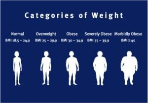 morbid obesity bmi