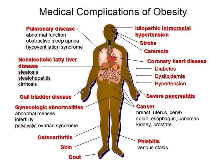 How Will Obesity Rates in the Future Affect Your Healthcare Career