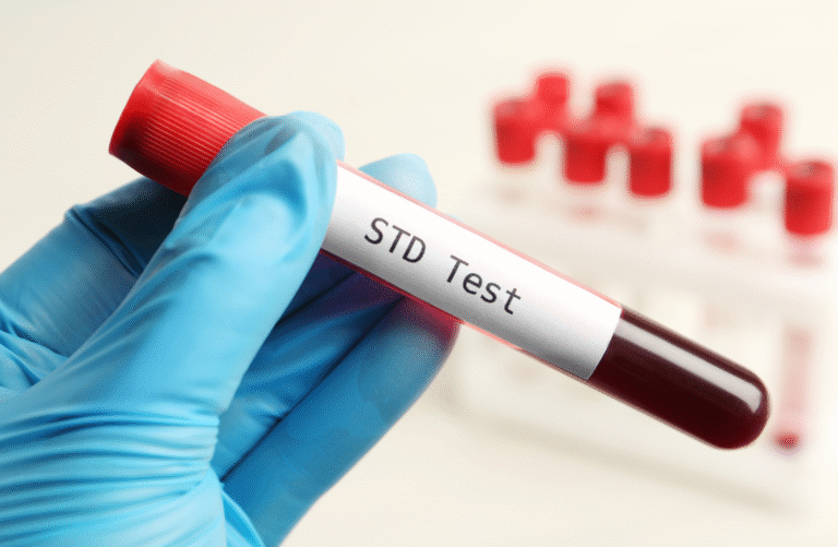 Can STDs go away on their own