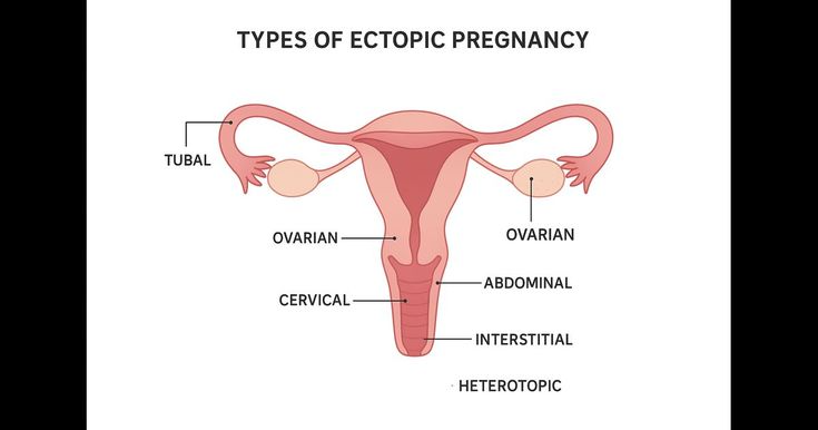 Ectopic Pregnancy Help & Care in Florida 2 image