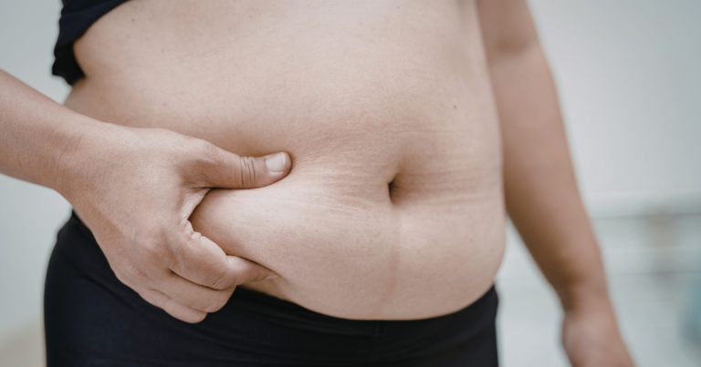 How to Remove Excess Salt From Body